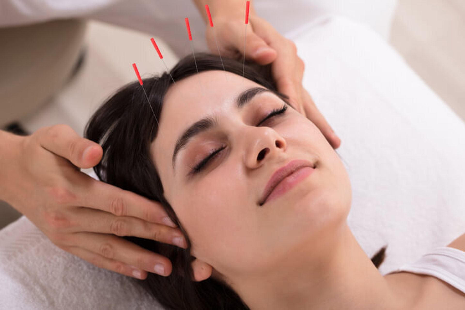 Kozmetik Akupunktur Nasıl Yapılır?